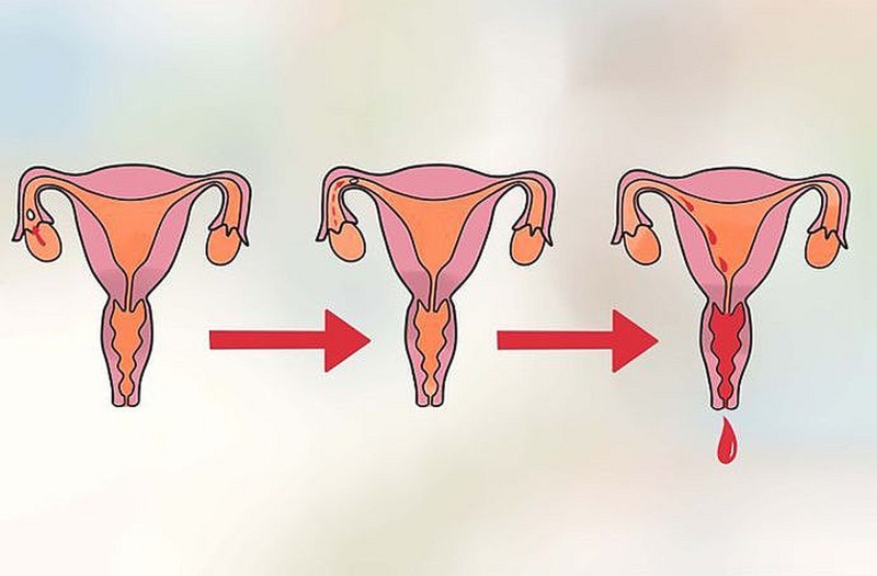 Что такое менструация?
