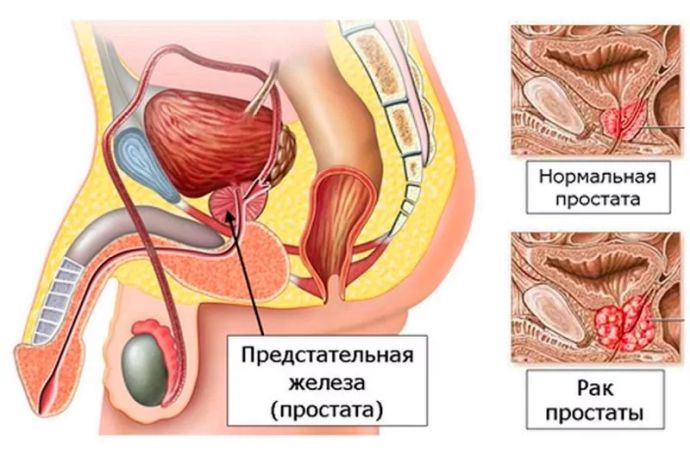 Простата (предстательная железа)